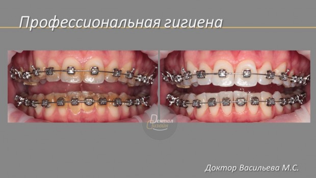 Гигиена